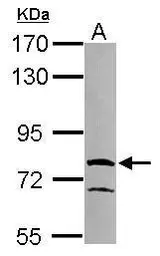 Anti-RUFY1 antibody [N3C3] used in Western Blot (WB). GTX119223